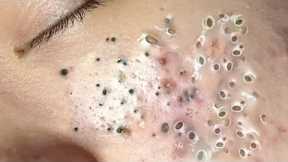 𝙍𝙚𝙡𝙖𝙭𝙞𝙣𝙜 𝙎𝙠𝙞𝙣𝙘𝙖𝙧𝙚 𝙍𝙤𝙪𝙩𝙞𝙣𝙚 𝘾𝙡𝙚𝙖𝙣𝙨𝙞𝙣𝙜 𝙛𝙤𝙧 𝙖 𝙋𝙚𝙖𝙘𝙚𝙛𝙪𝙡 𝙈𝙞𝙣𝙙 #43981